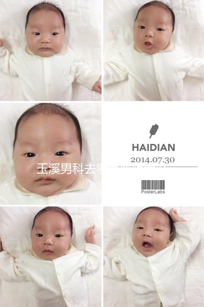 玉溪男科去哪家醫院看好,怎么選攻略,這個排行榜不要錯過