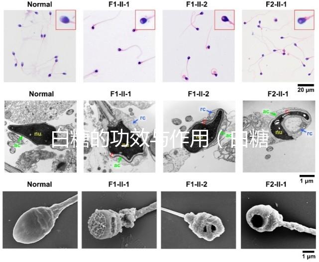 白糖的功效與作用（白糖的功效與作用及營(yíng)養(yǎng)價(jià)值）