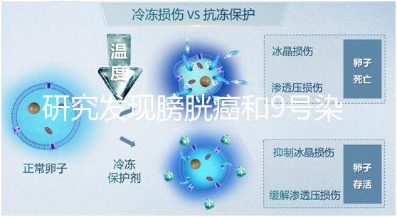 研究發現膀胱癌和9號染色體缺失有關系！