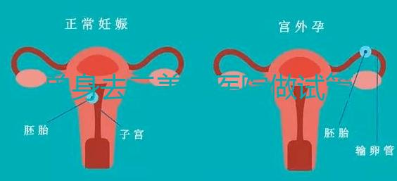 單身去三美泰醫(yī)院做試管需要花費多少錢?費用明細是怎么樣的