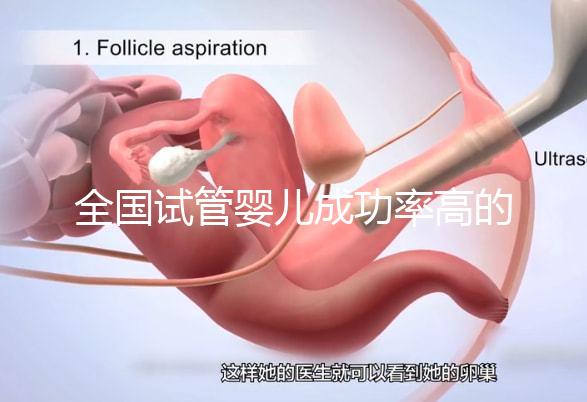全國試管嬰兒成功率高的醫院有哪些？（全國試管嬰兒成功率高的醫院目錄一覽）