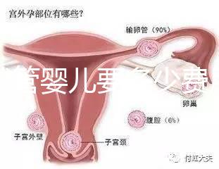 做試管嬰兒要多少費用（做試管嬰兒要多少費用？）