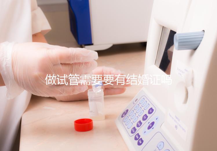 做試管需要要有結(jié)婚證嗎?