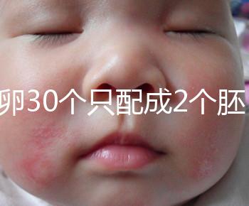 取卵30個只配成2個胚胎別放棄！卵巢傷口小移植成功率不低