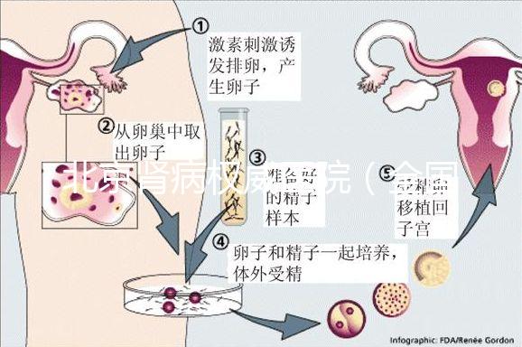 北京腎病權(quán)威醫(yī)院(全國腎病醫(yī)院排名一)
