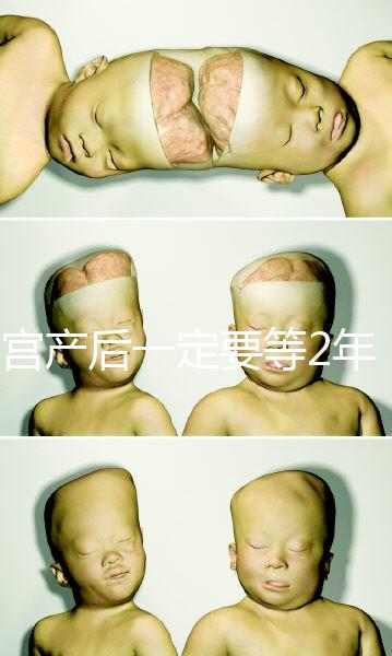 剖宮產后一定要等2年，才能試管嬰兒懷孕嗎？