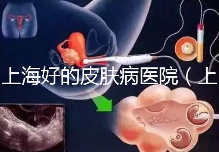 上海好的皮膚病醫(yī)院(上海皮膚科排名第一)