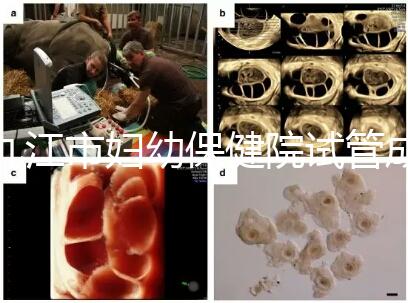 九江市婦幼保健院試管成功率高、費用低？生殖醫生揭開真相