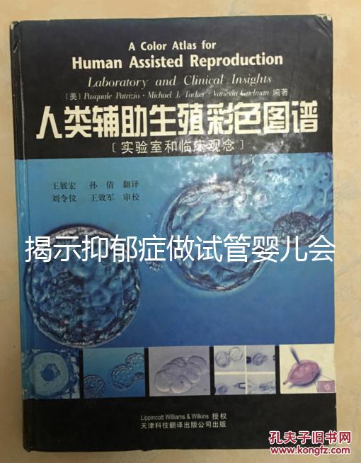 揭示抑郁癥做試管嬰兒會遺傳給女兒，想避免看這個(gè)