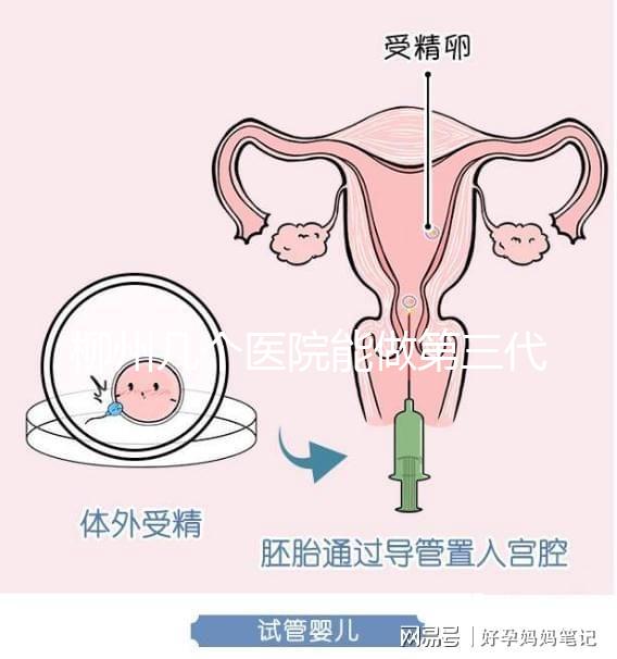 柳州幾個(gè)醫(yī)院能做第三代試管嬰兒？詳細(xì)的費(fèi)用成功率都在這