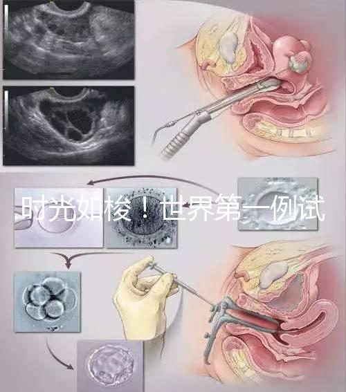 時光如梭！世界第一例試管嬰兒路易絲·布朗已經(jīng)41歲啦