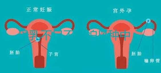 母乳不足不用怕!4種中藥催乳偏方分享