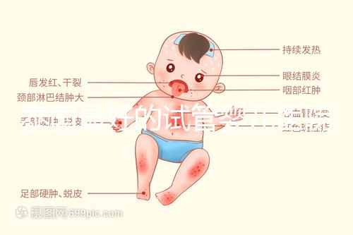泰國最好的試管嬰兒醫院是哪家?公布最新前十名