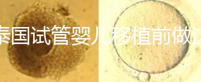 泰國試管嬰兒移植前做這3件事能提高成功率,不然會后悔!