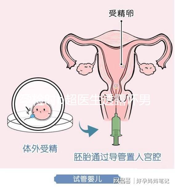 孕檢時b超醫生透露懷男寶女寶暗語寶典,一語戳中有心人!