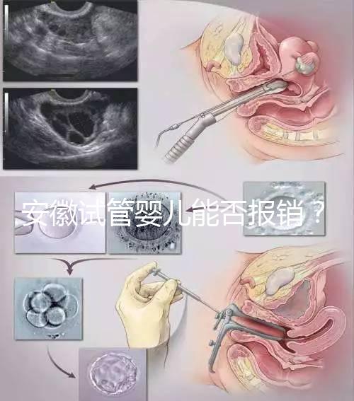 安徽試管嬰兒能否報(bào)銷?政策解讀幫您省錢!