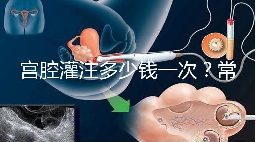 宮腔灌注多少錢一次？常見疑問匯總答疑