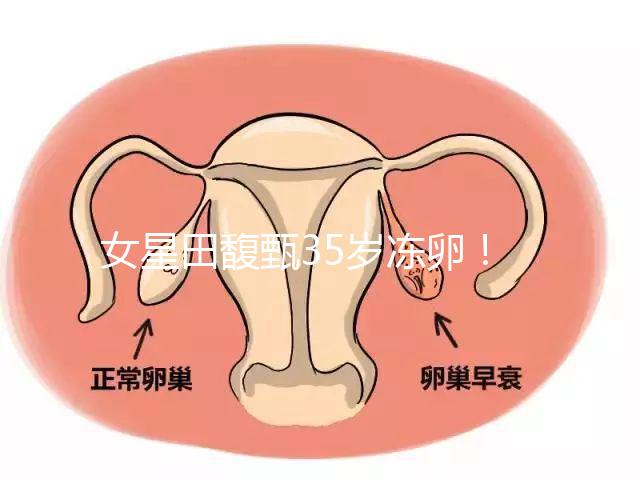 女星田馥甄35歲凍卵！揭秘你不知道的明星凍卵過程