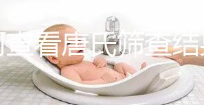 如何查看唐氏篩查結果,珠海醫院價格二百四起