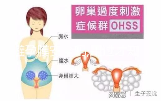 避孕膜安全嗎,用過才知道3點注意事項
