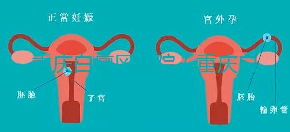 重慶白癜風(fēng)醫(yī)院(重慶白癜風(fēng)專科醫(yī)院在哪里)