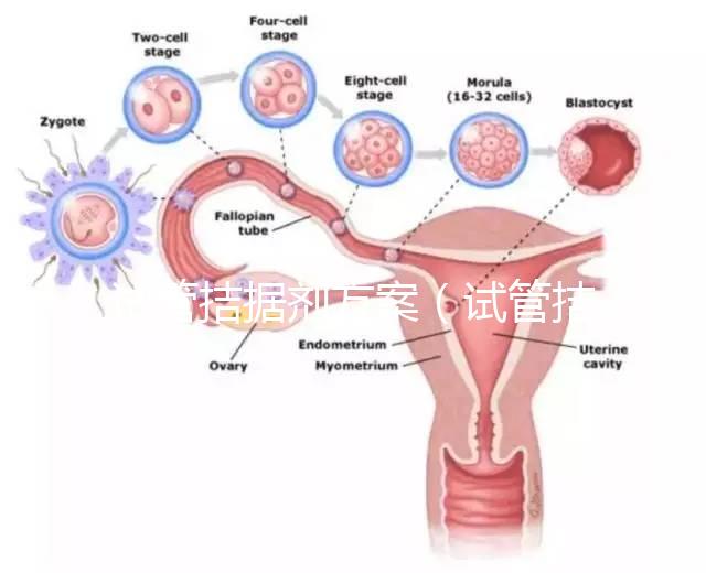 試管拮據劑方案（試管拮據劑方案是什么意思）