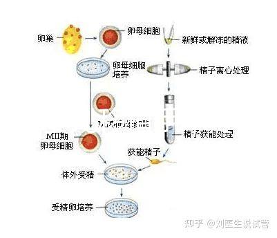 試管嬰兒移植手術(shù)疼嗎（試管失敗第二次收費嗎）
