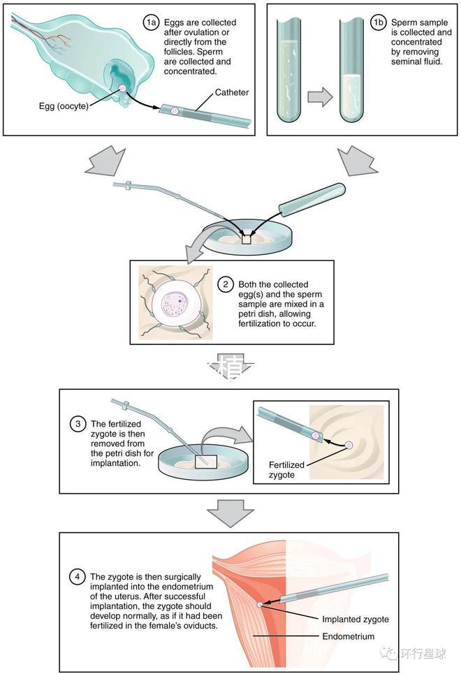 試管嬰兒移植手術(shù)（試管嬰兒移植手術(shù)需要多長時(shí)間）