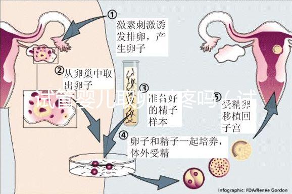 試管嬰兒取卵時(shí)疼嗎（試管嬰兒取卵時(shí)疼嗎,取卵多長(zhǎng)時(shí)間才是移植）