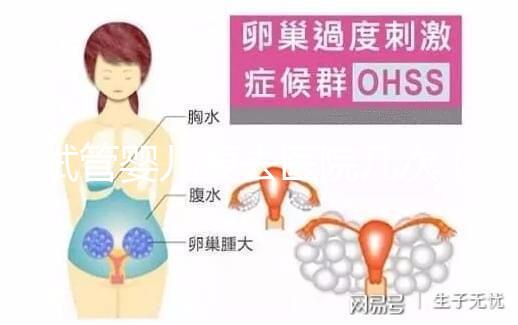 試管嬰兒要去醫院幾次（試管嬰兒要去醫院幾次？）