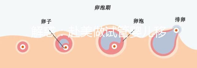 解惑:赴美做試管嬰兒移植兩個(gè)囊胚-生雙胞胎的概率