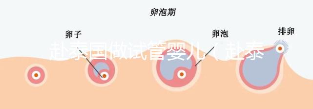 赴泰國做試管嬰兒(赴泰國做試管嬰兒要多少錢)