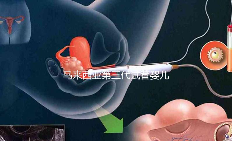 馬來西亞第三代試管嬰兒成功率真不差,一次成功真的很簡(jiǎn)單