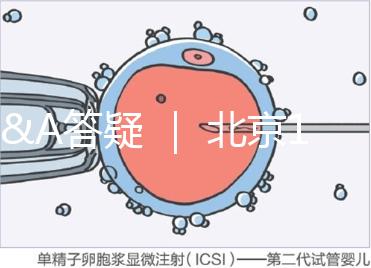 Q&A答疑 | 北京16項輔助生殖技術(shù)進(jìn)醫(yī)保,試管可以報銷嗎?