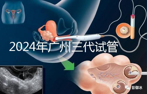 2024年廣州三代試管嬰兒費用明細(xì)公布！